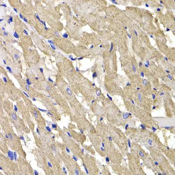 IHC-P analysis of rat heart tissue using GTX64661 MPI antibody. Dilution : 1:100
