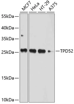 WB analysis of various sample lysates using GTX64664 TPD52 antibody. Dilution : 1:1000 Loading : 25microg per lane WB analysis of various sample lysates using GTX64664 TPD52 antibody. Dilution : 1:1000 Loading : 25microg per lane