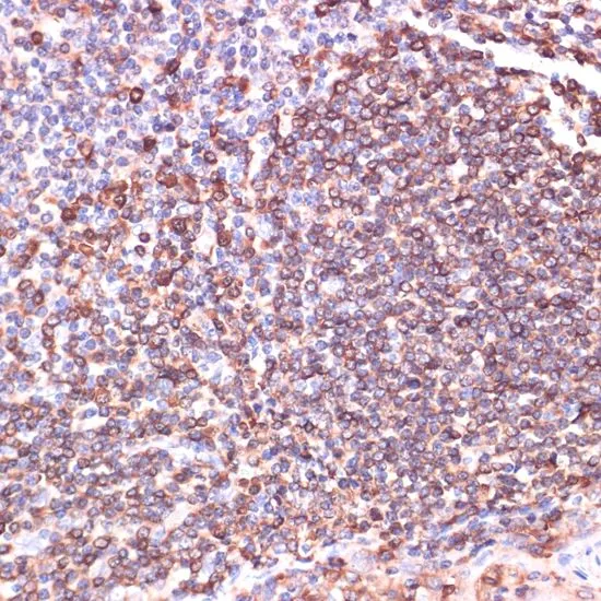 IHC-P analysis of human tonsil tissue using GTX64664 TPD52 antibody. Dilution : 1:100