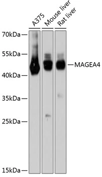 WB analysis of various sample lysates using GTX64668 MAGEA4 antibody. Dilution : 1:3000 Loading : 25microg per lane