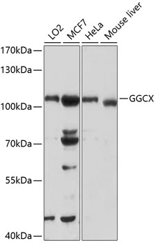 WB analysis of various sample lysates using GTX64670 GGCX antibody. Dilution : 1:1000 Loading : 25microg per lane WB analysis of various sample lysates using GTX64670 GGCX antibody. Dilution : 1:1000 Loading : 25microg per lane