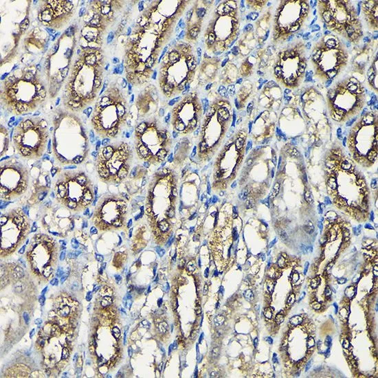 IHC-P analysis of mouse kidney tissue using GTX64671 USP5 antibody. Dilution : 1:100