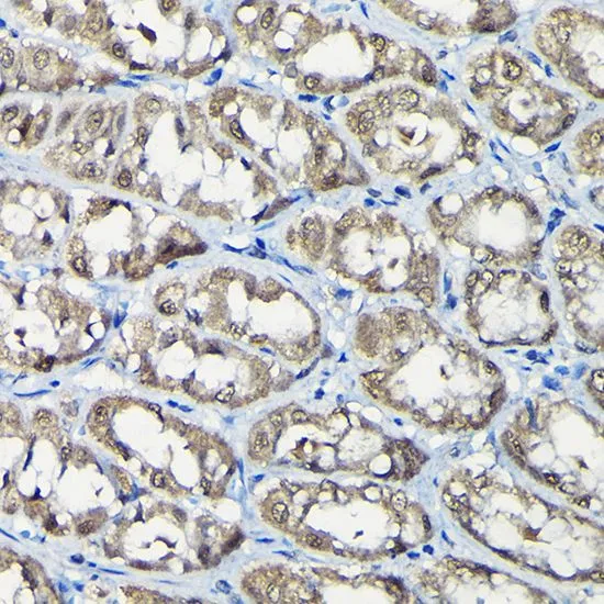 IHC-P analysis of rat stomach tissue using GTX64671 USP5 antibody. Dilution : 1:100