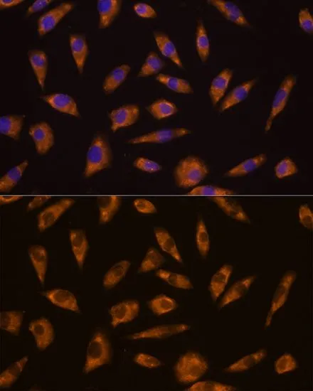 ICC/IF analysis of L929 cells using GTX64676 GLP1R antibody. Blue : DAPI Dilution : 1:100