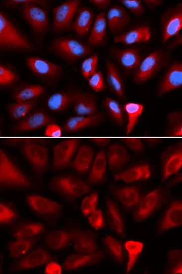 ICC/IF analysis of U2OS cells using GTX64678 FKBP4 antibody. Blue : DAPI