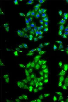 ICC/IF analysis of MCF7 cells using GTX64680 TEM8 antibody. Blue : DAPI