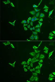 ICC/IF analysis of U2OS cells using GTX64681 PIB5PA antibody. Blue : DAPI