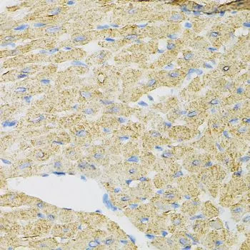 IHC-P analysis of mouse heart tissue using GTX64681 PIB5PA antibody. Dilution : 1:100