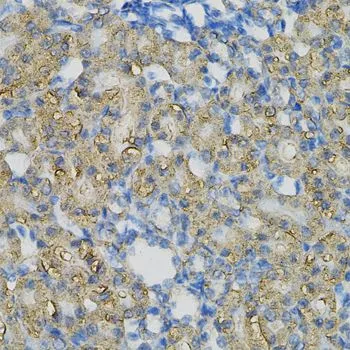 IHC-P analysis of rat kidney tissue using GTX64681 PIB5PA antibody. Dilution : 1:100