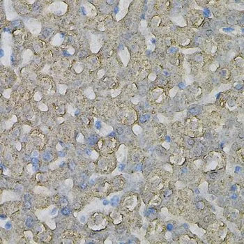 IHC-P analysis of rat liver tissue using GTX64681 PIB5PA antibody. Dilution : 1:100