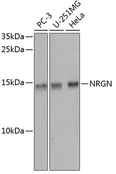 WB analysis of various sample lysates using GTX64685 Neurogranin antibody. Dilution : 1:1000 Loading : 25microg per lane WB analysis of various sample lysates using GTX64685 Neurogranin antibody. Dilution : 1:1000 Loading : 25microg per lane