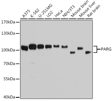 WB analysis of various sample lysates using GTX64691 PARG antibody. Dilution : 1:7000 Loading : 25microg per lane WB analysis of various sample lysates using GTX64691 PARG antibody. Dilution : 1:7000 Loading : 25microg per lane