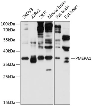 WB analysis of various sample lysates using GTX64694 PMEPA1 antibody. Dilution : 1:3000 Loading : 25microg per lane WB analysis of various sample lysates using GTX64694 PMEPA1 antibody. Dilution : 1:3000 Loading : 25microg per lane