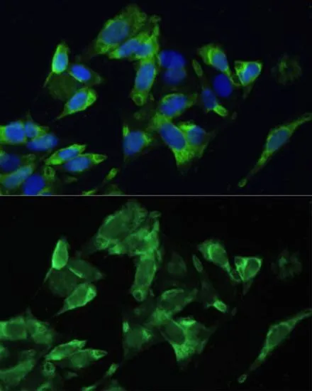 ICC/IF analysis of U2OS cells using GTX64694 PMEPA1 antibody. Blue : DAPI Dilution : 1:100