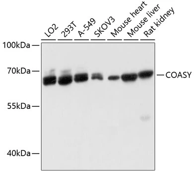 WB analysis of various sample lysates using GTX64695 COASY antibody. Dilution : 1:3000 Loading : 25microg per lane WB analysis of various sample lysates using GTX64695 COASY antibody. Dilution : 1:3000 Loading : 25microg per lane
