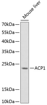 WB analysis of mouse liver tissue lysate using GTX64697 ACP1 antibody. Dilution : 1:1000 Loading : 25microg per lane WB analysis of mouse liver tissue lysate using GTX64697 ACP1 antibody. Dilution : 1:1000 Loading : 25microg per lane