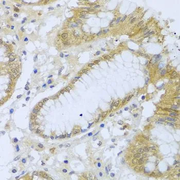 IHC-P analysis of human stomach tissue using GTX64697 ACP1 antibody. Dilution : 1:100