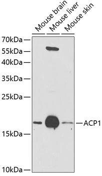 WB analysis of various sample lysates using GTX64698 ACP1 antibody. The signal was developed with ECL plus-Enhanced. Dilution : 1:1000 Loading : 25microg per lane
