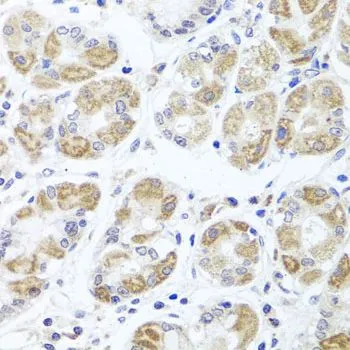 IHC-P analysis of human stomach tissue using GTX64698 ACP1 antibody. Dilution : 1:100