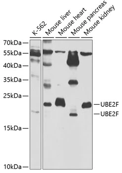 WB analysis of various sample lysates using GTX64701 NCE2 antibody. Dilution : 1:1000 Loading : 25microg per lane WB analysis of various sample lysates using GTX64701 NCE2 antibody. Dilution : 1:1000 Loading : 25microg per lane