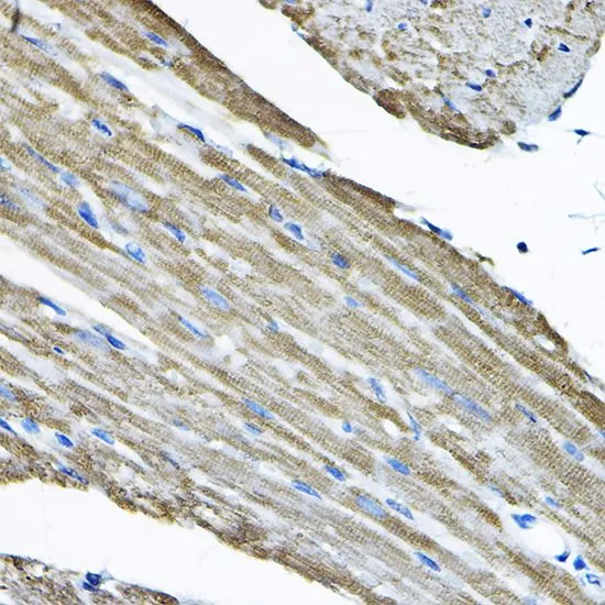 IHC-P analysis of mouse heart tissue using GTX64701 NCE2 antibody. Dilution : 1:200