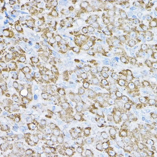 IHC-P analysis of rat ovary tissue using GTX64701 NCE2 antibody. Dilution : 1:200