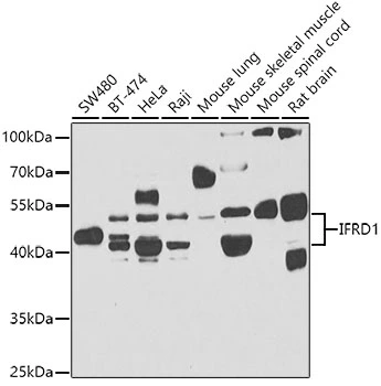 WB analysis of various sample lysates using GTX64705 IFRD1 antibody. Dilution : 1:1000 Loading : 25microg per lane WB analysis of various sample lysates using GTX64705 IFRD1 antibody. Dilution : 1:1000 Loading : 25microg per lane