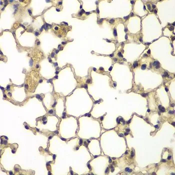 IHC-P analysis of mouse lung tissue using GTX64705 IFRD1 antibody. Dilution : 1:100