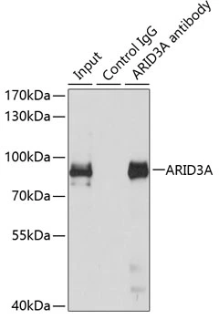 IP analysis of MCF7 cell lysate using GTX64706 DRIL1 antibody. Antibody amount : 3microg / 150microg lysate Dilution : 1:500 IP analysis of MCF7 cell lysate using GTX64706 DRIL1 antibody. Antibody amount : 3microg / 150microg lysate Dilution : 1:500