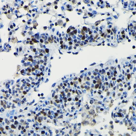 IHC-P analysis of rat lung tissue using GTX64706 DRIL1 antibody. Dilution : 1:100