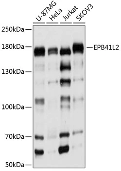 WB analysis of various sample lysates using GTX64708 EPB41L2 antibody. Dilution : 1:1000 Loading : 25microg per lane WB analysis of various sample lysates using GTX64708 EPB41L2 antibody. Dilution : 1:1000 Loading : 25microg per lane