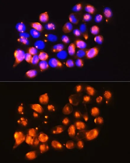 ICC/IF analysis of HeLa cells using GTX64708 EPB41L2 antibody. Blue : DAPI Dilution : 1:100