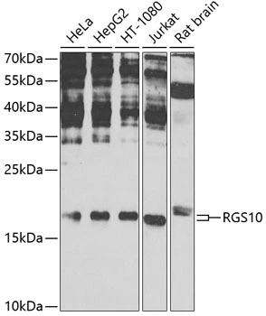 WB analysis of various sample lysates using GTX64712 RGS10 antibody. The signal was developed with ECL plus-Enhanced. Dilution : 1:1000 Loading : 25microg per lane