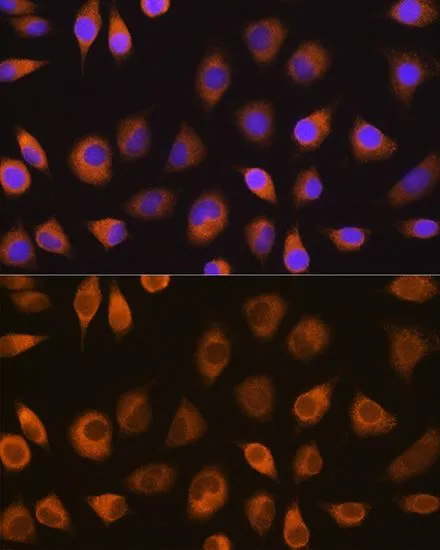 ICC/IF analysis of L929 cells using GTX64717 SEL1L antibody. Blue : DAPI Dilution : 1:100