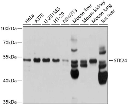 WB analysis of various sample lysates using GTX64721 MST3 antibody. Dilution : 1:1000 Loading : 25microg per lane WB analysis of various sample lysates using GTX64721 MST3 antibody. Dilution : 1:1000 Loading : 25microg per lane