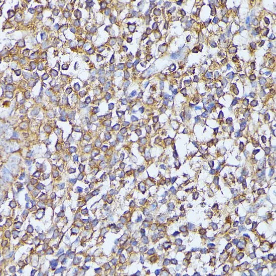 IHC-P analysis of human tonsil tissue using GTX64721 MST3 antibody. Dilution : 1:100