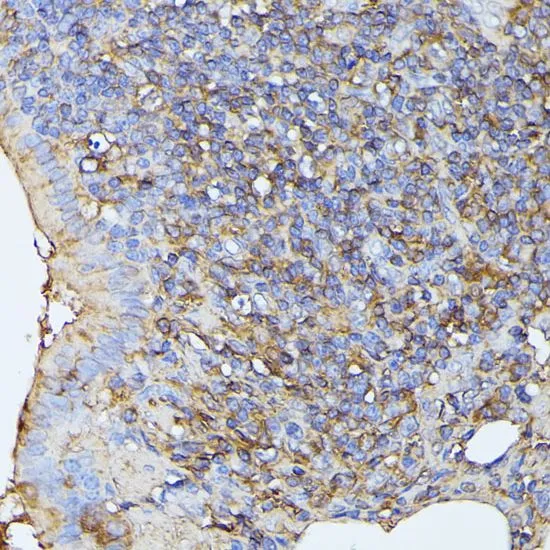 IHC-P analysis of rat lung tissue using GTX64721 MST3 antibody. Dilution : 1:100
