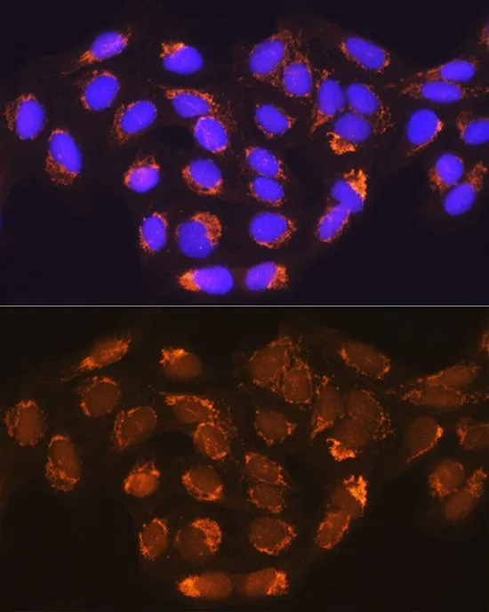 ICC/IF analysis of U2OS cells using GTX64725 MUT antibody. Blue : DAPI Dilution : 1:100