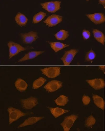 ICC/IF analysis of L929 cells using GTX64731 CSDE1 antibody. Blue : DAPI Dilution : 1:100