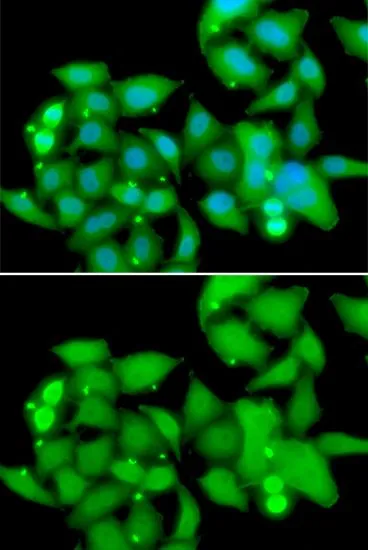 ICC/IF analysis of A549 cells using GTX64736 Sts1 antibody. Blue : DAPI