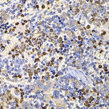IHC-P analysis of rat spleen tissue using GTX64736 Sts1 antibody. Dilution : 1:100