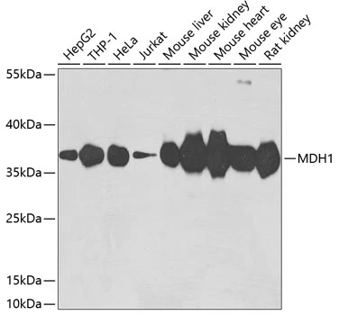 WB analysis of various sample lysates using GTX64737 MDH1 antibody. Dilution : 1:3000 Loading : 25microg per lane WB analysis of various sample lysates using GTX64737 MDH1 antibody. Dilution : 1:3000 Loading : 25microg per lane