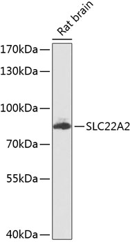 WB analysis of rat brain tissue lysate using GTX64738 SLC22A2 antibody. Dilution : 1:1000 Loading : 25ug per lane