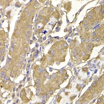 IHC-P analysis of human stomach tissue using GTX64744 RASGRF1 antibody. Dilution : 1:100