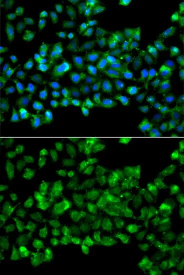 ICC/IF analysis of A549 cells using GTX64745 CBR3 antibody. Blue : DAPI