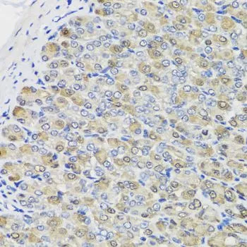 IHC-P analysis of mouse stomach tissue using GTX64745 CBR3 antibody. Dilution : 1:100