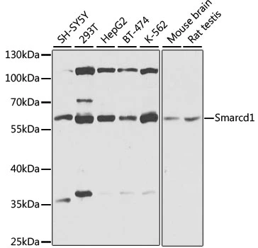 WB analysis of various sample lysates using GTX64747 SMARCD1 antibody. Dilution : 1:1000 Loading : 25microg per lane WB analysis of various sample lysates using GTX64747 SMARCD1 antibody. Dilution : 1:1000 Loading : 25microg per lane