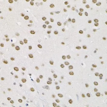 IHC-P analysis of mouse brain tissue using GTX64747 SMARCD1 antibody. Dilution : 1:100