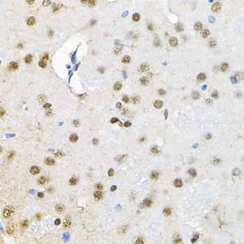 IHC-P analysis of rat brain tissue using GTX64747 SMARCD1 antibody.