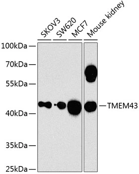 WB analysis of various sample lysates using GTX64750 TMEM43 antibody. The signal was developed with ECL plus-Enhanced. Dilution : 1:1000 Loading : 25microg per lane WB analysis of various sample lysates using GTX64750 TMEM43 antibody. The signal was developed with ECL plus-Enhanced. Dilution : 1:1000 Loading : 25microg per lane